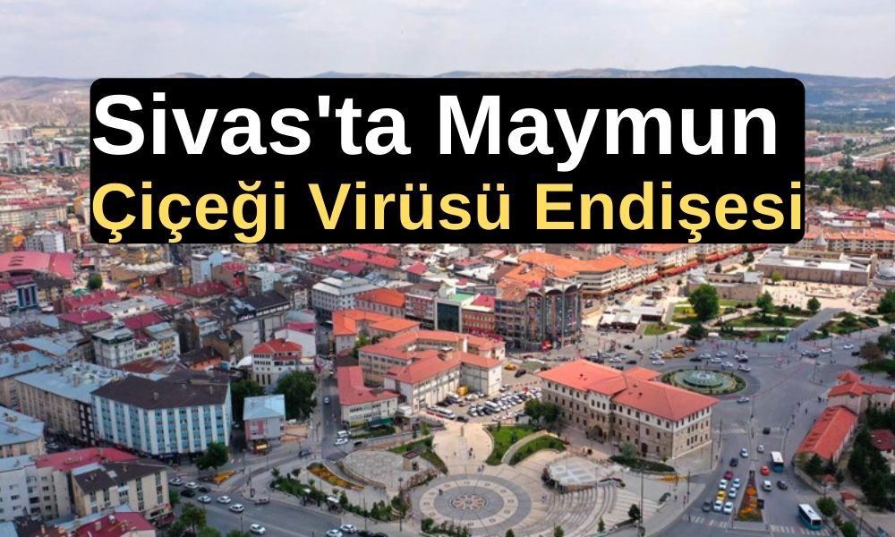 Sivas'ta Maymun Çiçeği Virüsü Endişesi