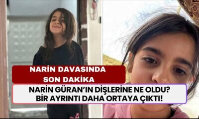 Narin Güran’ın Dişlerine Ne Oldu? Narin Cinayetinde Kan Donduran Bir Ayrıntı Daha Ortaya Çıktı!